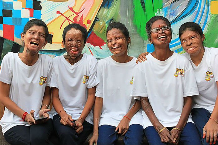 Acid Attack Victims Need Love and Compassion